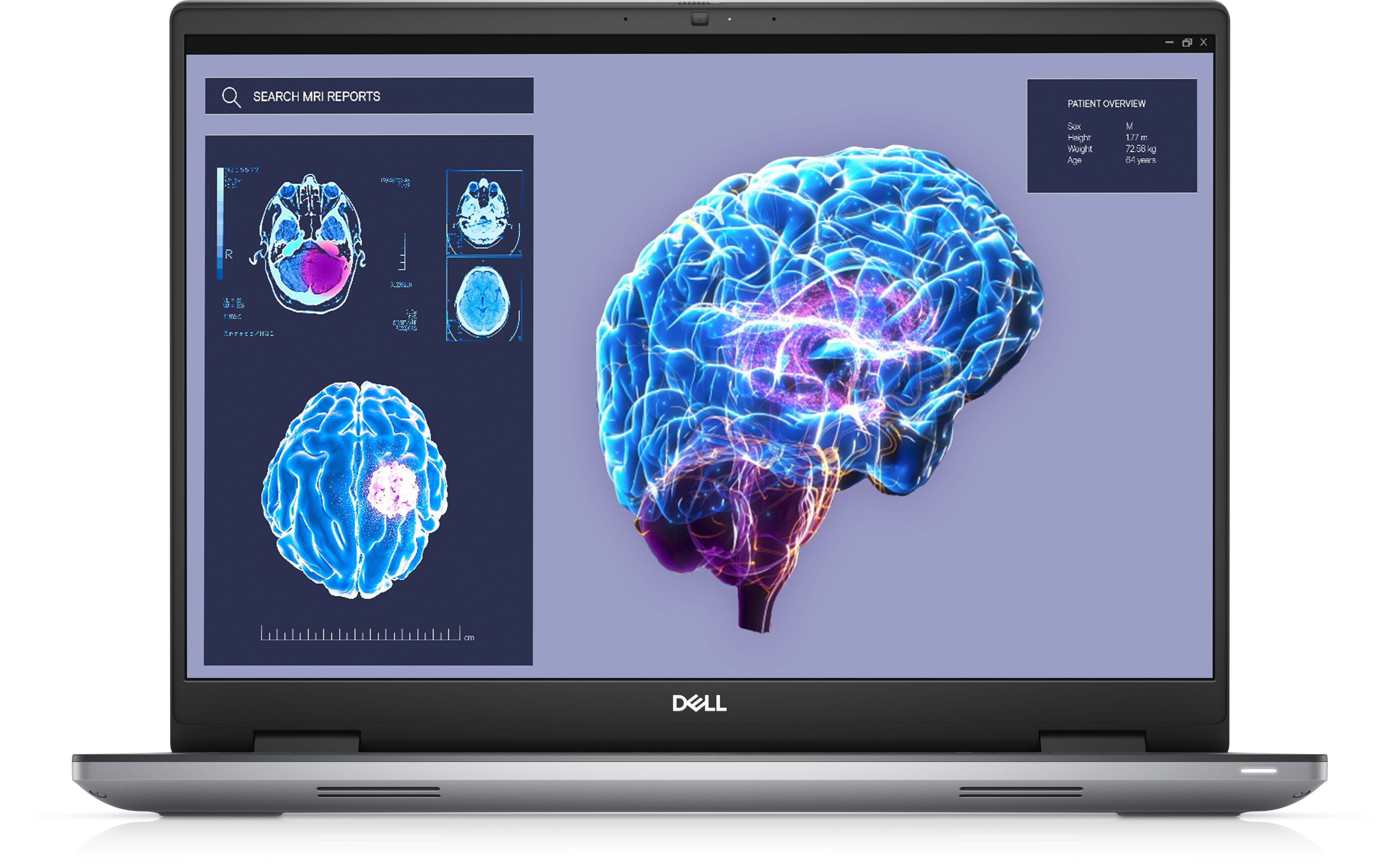 Dell Precision 7680 - Intel Core i7 13850HX - Win 11 Pro - NVIDIA RTX 2000 Ada - 32 GB RAM - 1 TB SSD NVMe, Class 40 - 40.64 cm (16") Dell Precision 7680 - Intel Core i7 13850HX - Win 11 Pro - NVIDIA RTX 2000 Ada - 32 GB RAM - 1 TB SSD NVMe, Class 40 - 40.64 cm (16")