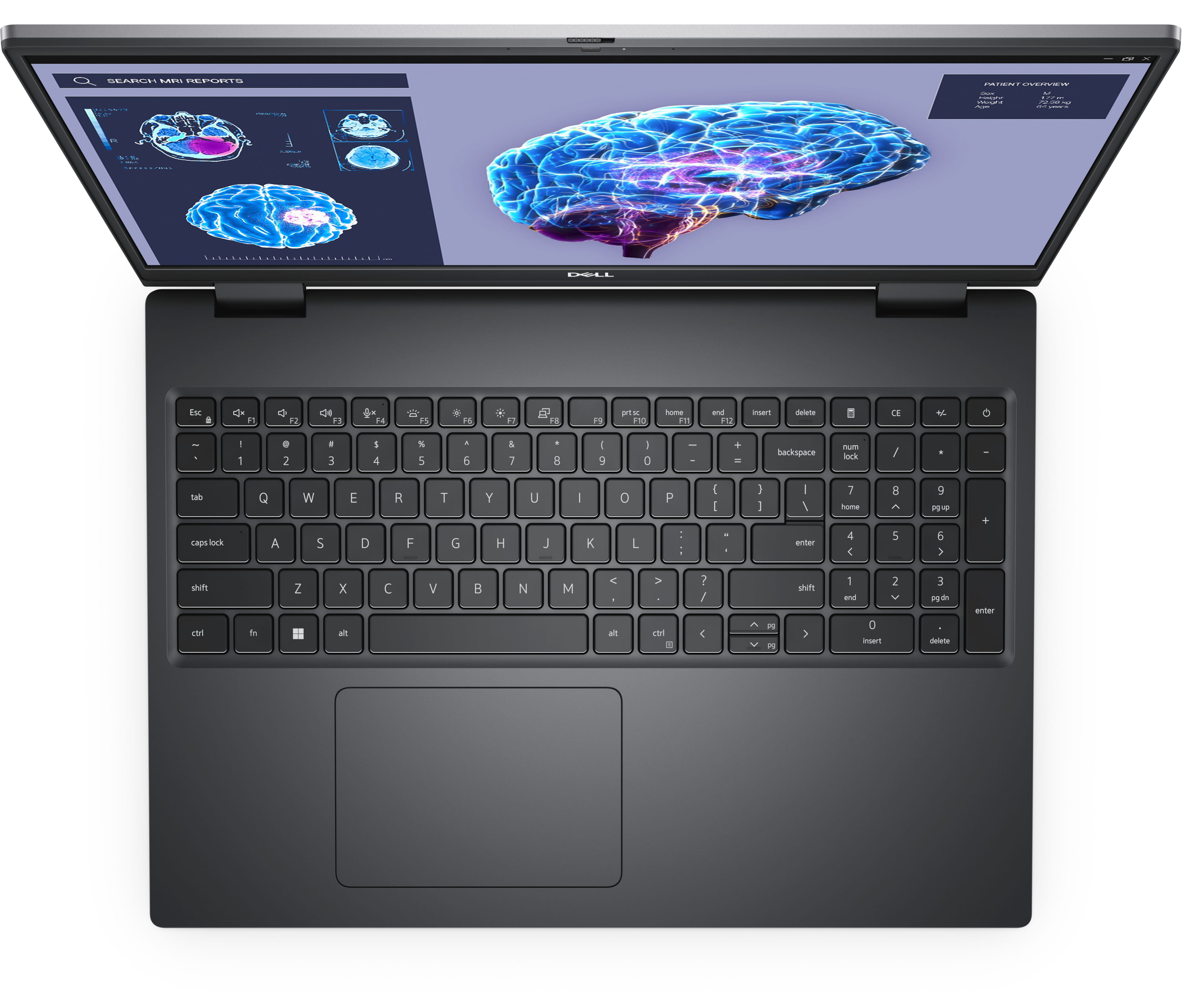 Dell Precision 7680 - Intel Core i7 13850HX - Win 11 Pro - NVIDIA RTX 2000 Ada - 32 GB RAM - 1 TB SSD NVMe, Class 40 - 40.64 cm (16") Dell Precision 7680 - Intel Core i7 13850HX - Win 11 Pro - NVIDIA RTX 2000 Ada - 32 GB RAM - 1 TB SSD NVMe, Class 40 - 40.64 cm (16")